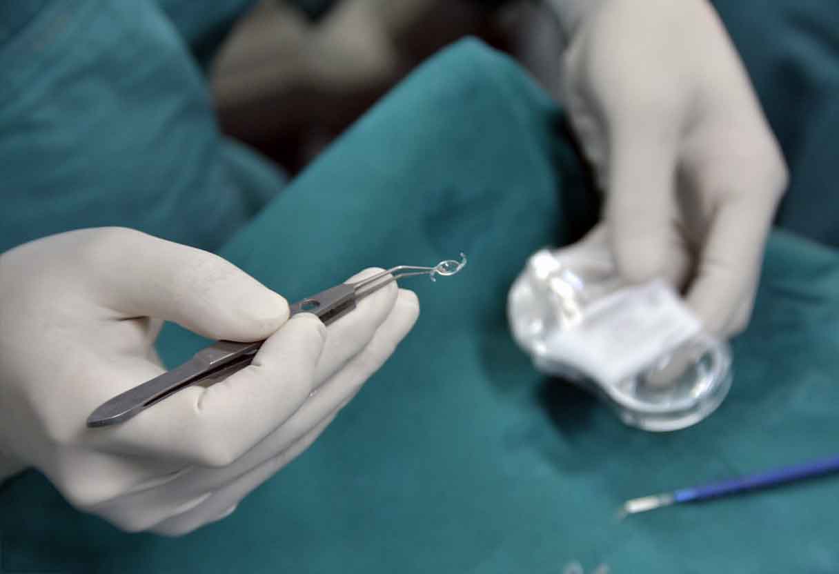 アイドリームズ眼科医療機器販売